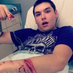 Andrew vance shark attack