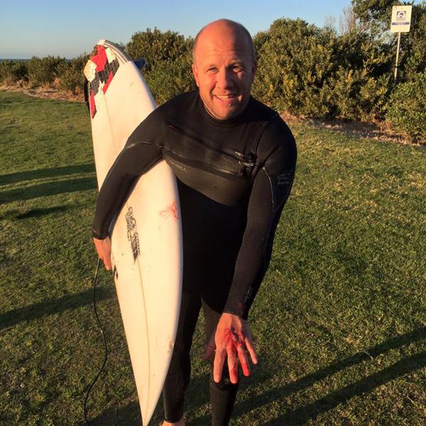 The surfer via 101.3 SeaFM