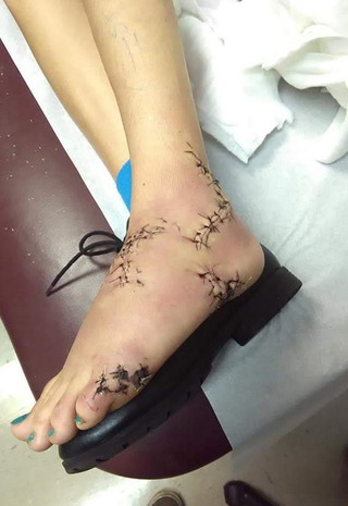 Krystal MaGee injury Family Photo.
