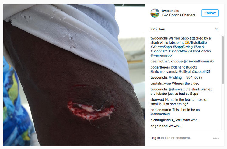 Mr. Sapp's shark bite Photo: Jack Carlson's charter, Two Conchs via Instagram