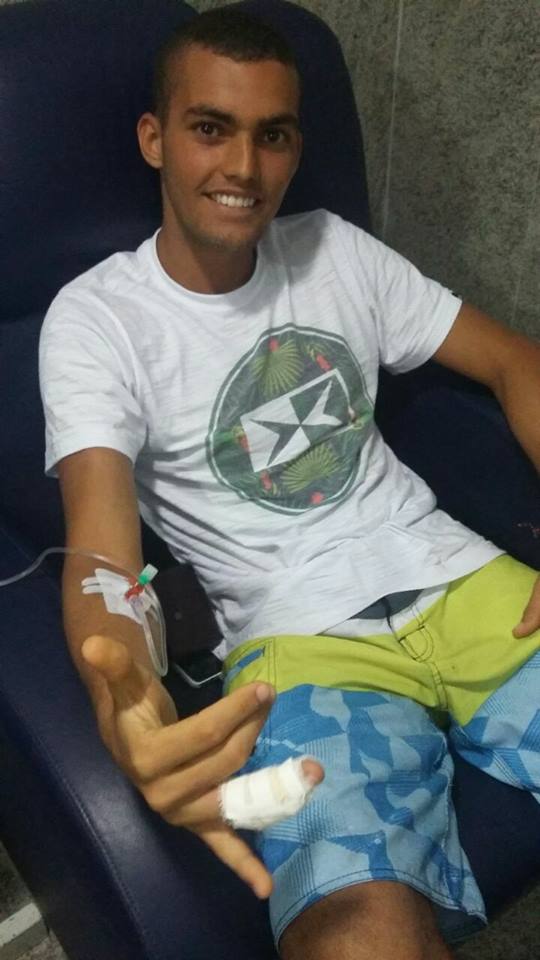 Arthur Andrade_2017_shark_attack_bite_brazil