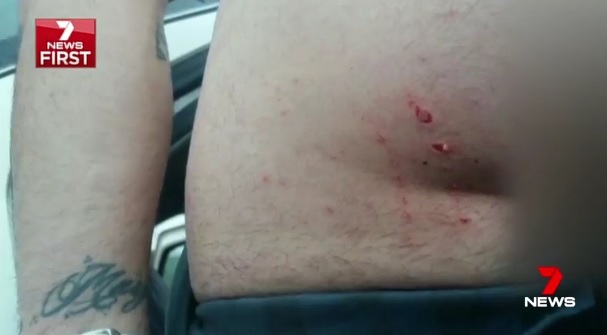 Killalea_State_Park_.Gonzalo Mompo Fernandez _2017_shark_attack_bite_