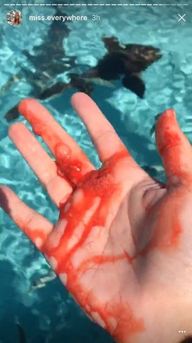 2017_shark_attack_bite_Exuma_Kay_Bahamas