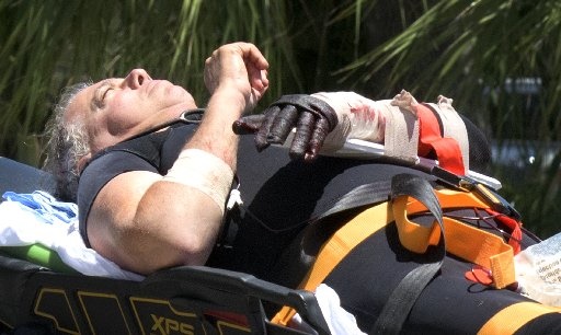 2017_shark_attack_bite_Florida_Randall_Jordan_Melanie Bell The Palm Beach Post