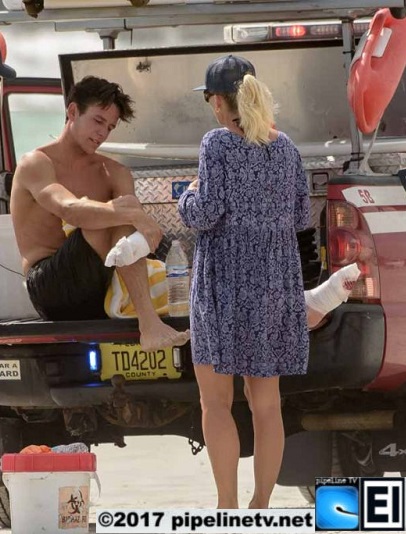 2017_Shark_attack_Bite_Florida_Bryan_Brock_PipelineTV