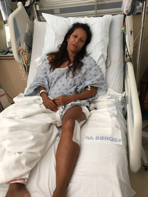 2018_shark_Attack_Marjorie Mariano_Haleiwa_Hawaii