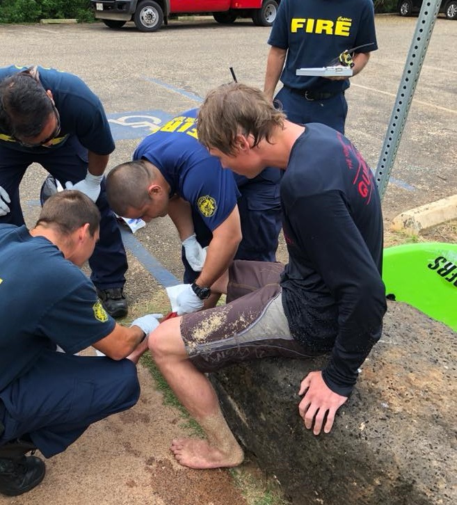 2018 shark attack bite Dylan_McWilliams_Keoneloa Bay, Kauai, Hawaii_4.19.18_2