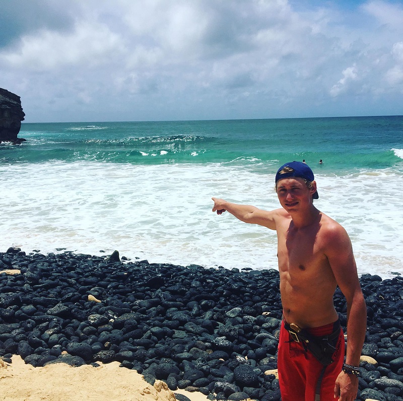 Dylan McWilliams points to where he was bitten by a tiger shark