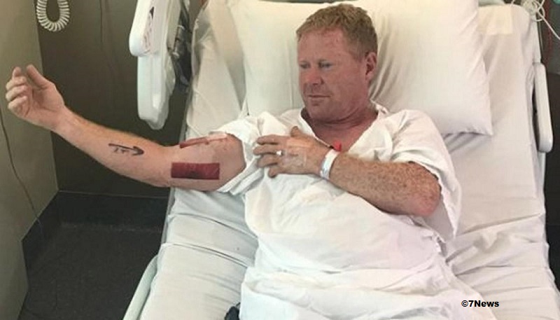 bodysurfer was bitten by a shark in New South Wales, Australia