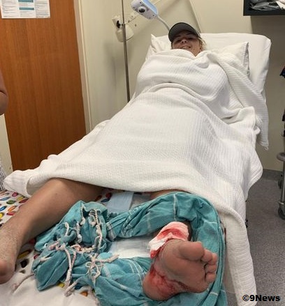 Isabella Brett-Jensen in the hostpital after a wobbegong shark bit her foot 