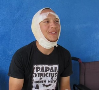 Surfer lands on lemon shark in shallows, gets bitten in Brazil