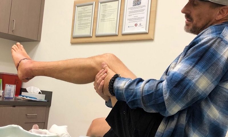 Experienced surfer thought a shark wouldn’t bite him