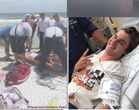 Surfer bitten by shark at Ocean Isle Beach, North Carolina