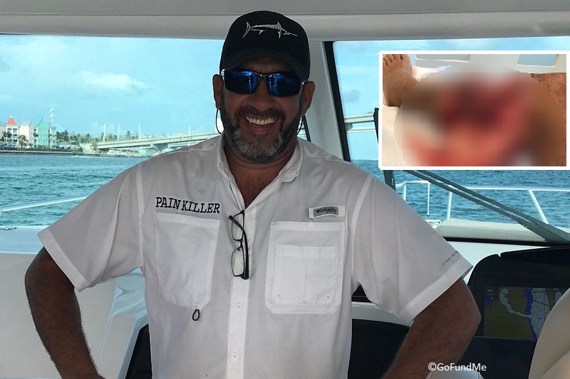 Bahamas snorkeler nearly loses leg in shark attack in fourth incident this year.