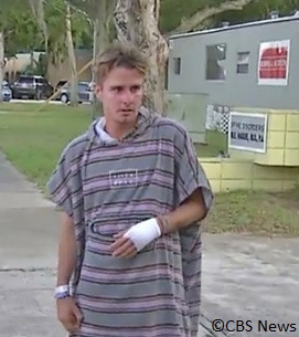 surfer bitten on the hand by a shark in Florida.