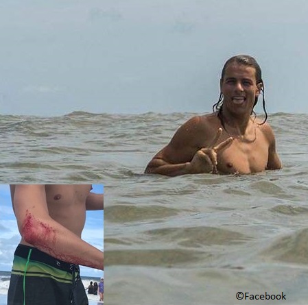 two shark bites on the same day in Florida.