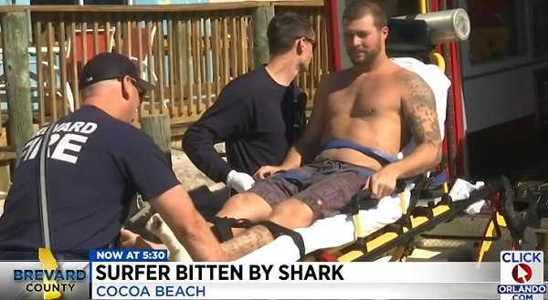 cocoa beach shark bite patient