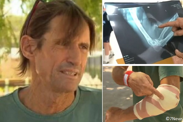 Peter O'Halloran was bitten on the arm by a shark while snorkeling.