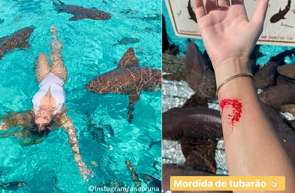 model bitten by nurse shark in the Bahamas 