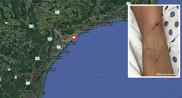 2 people bitten by sharks Monday in Myrtle Beach