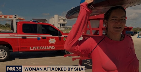 Carolinna Jones was bitten by a shakr in Florida