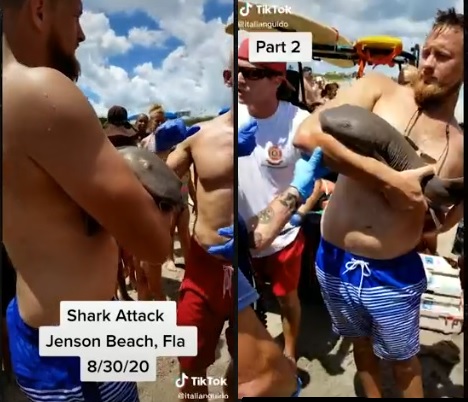 nurse shark won't let go of man's arm