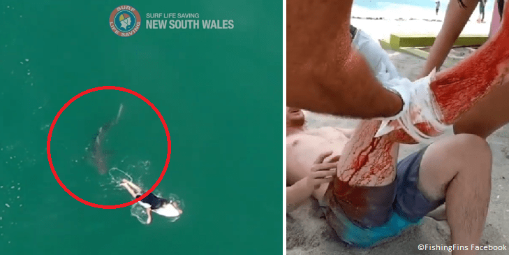 shark bite in Miami surfer hit by shark in Australia