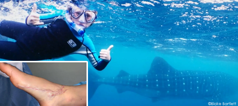 Bartlett swam with a whale shark a few days before a shark attacked his foot in Western Austrailia.