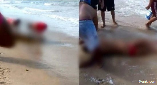 The shark attack victim on shore