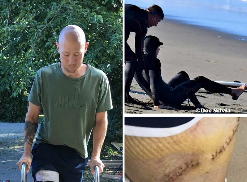 Eric Steinley was bitten by a great white shark