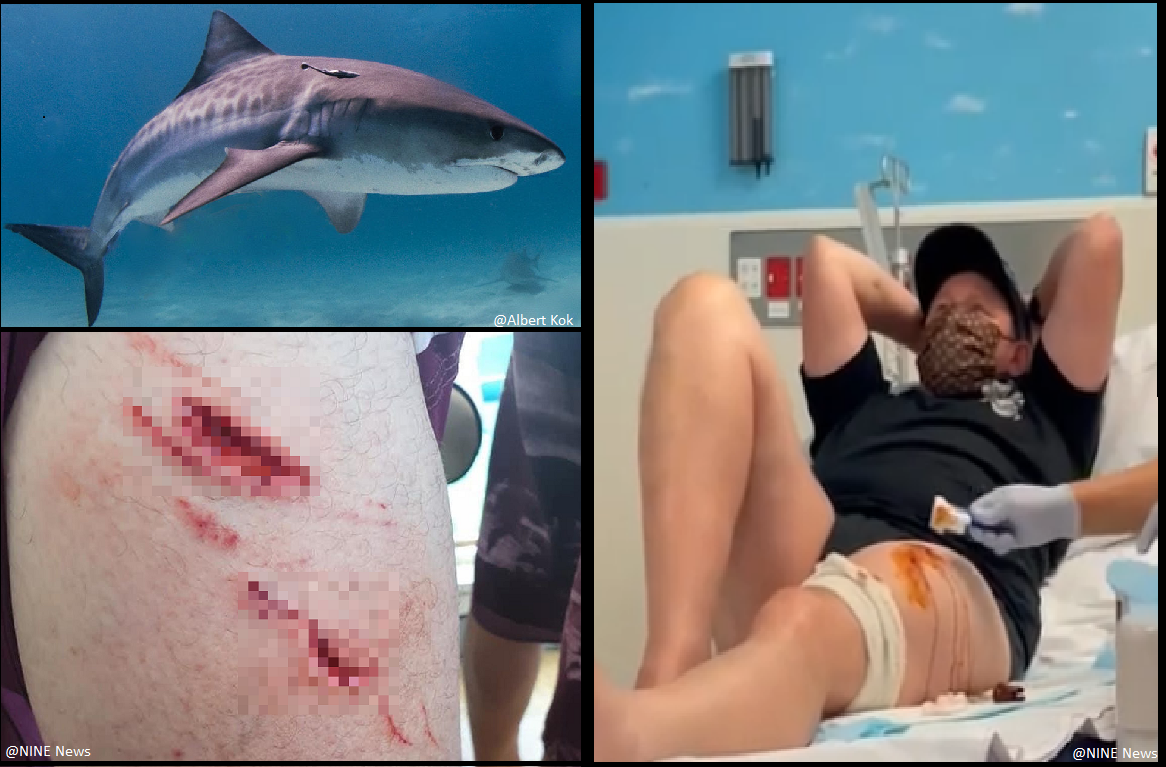 Tiger shark bite in queensland, Austrailia