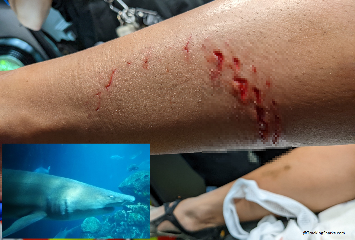 South Carolina Kiawah Island shark attack