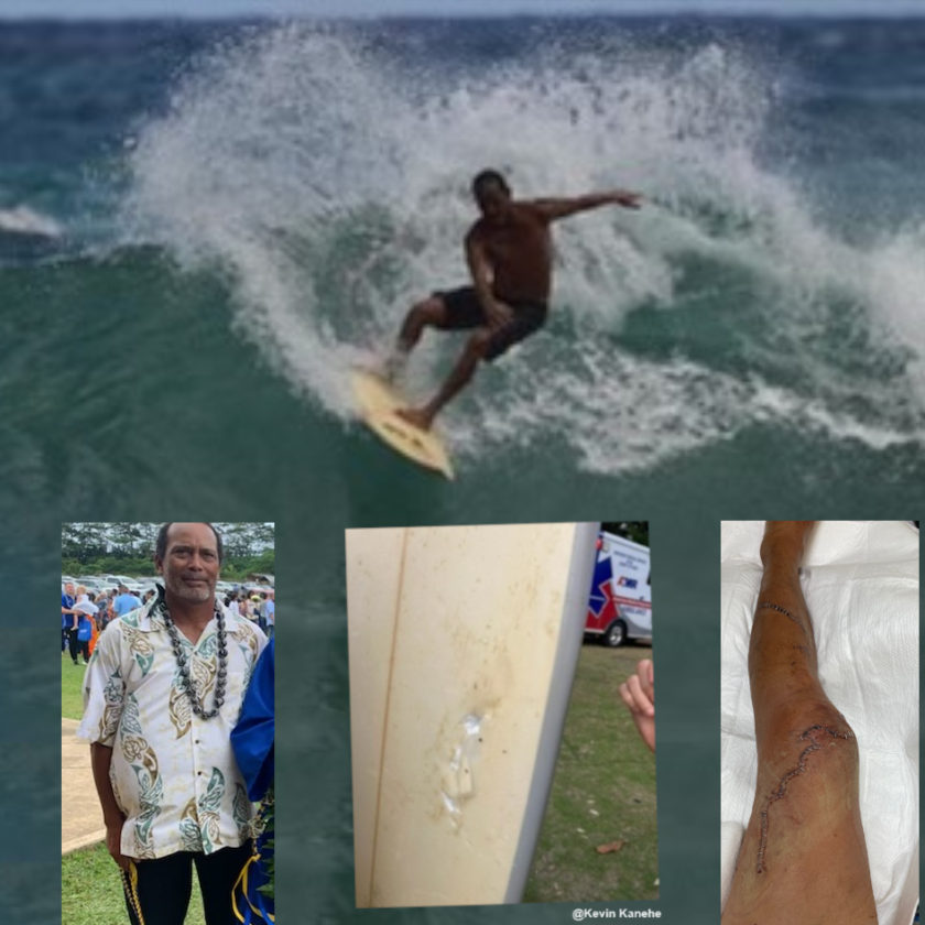 Kevin Kanehe leg and shark damaged surf board.
